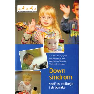 Down sindrom